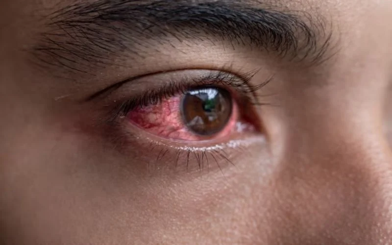 Understanding and Managing Eye Disorders for a Brighter Future
